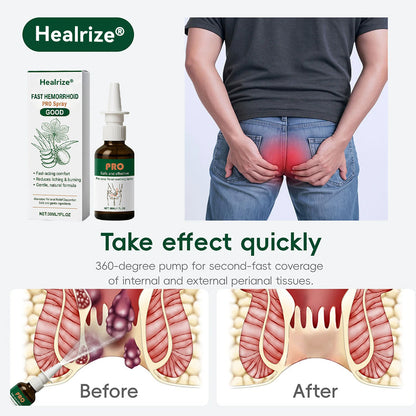 🥳2026 HOT SALE🥳 Healrize® Fast Hemorrhoid PRO Spray